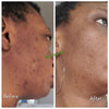 Ayurvedic Body & Facial Skincare Set ( Pack of 6)
