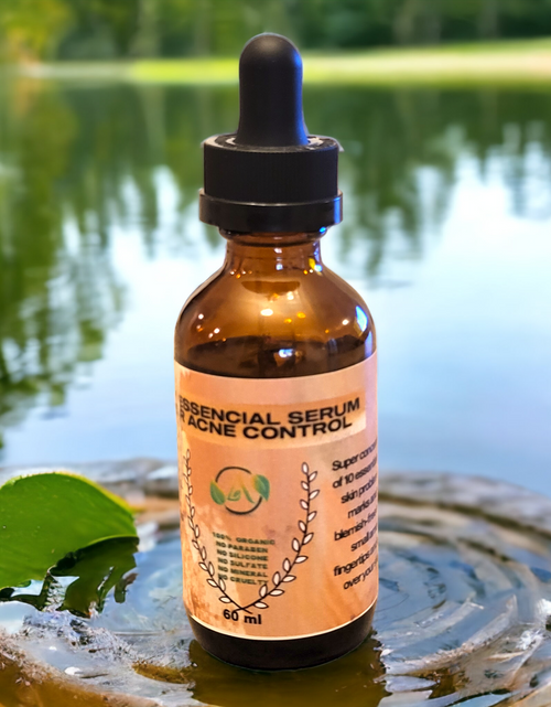 Load image into Gallery viewer, Essential Acne Control Oil