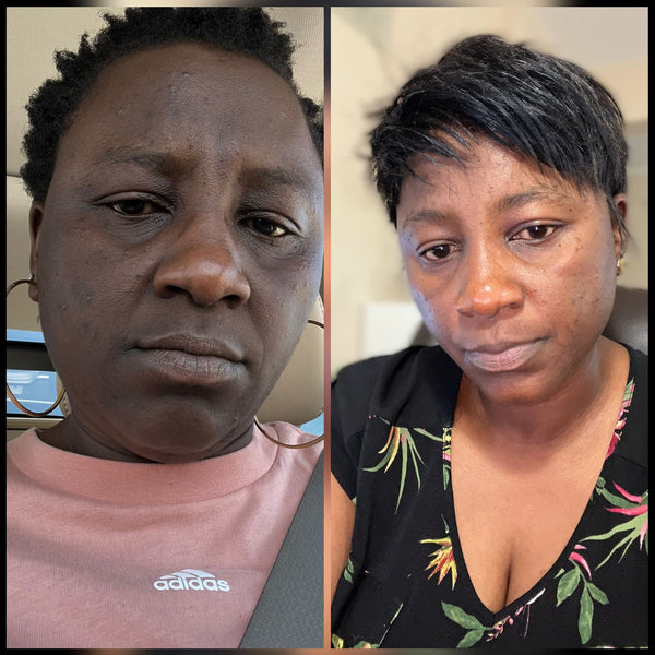 Brightening Plant-Based Set with Carrot and Rosehip Set