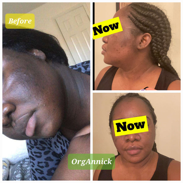 OrgAnnick Natural Ayurvedic Skincare Set (6-Pack) – Herbal Body Cream, Scrub, Soap, Toner, Serum & Cleanser with Red Palm & Kernel Oil – Paraben-Free, Sulfate-Free, Silicone-Free