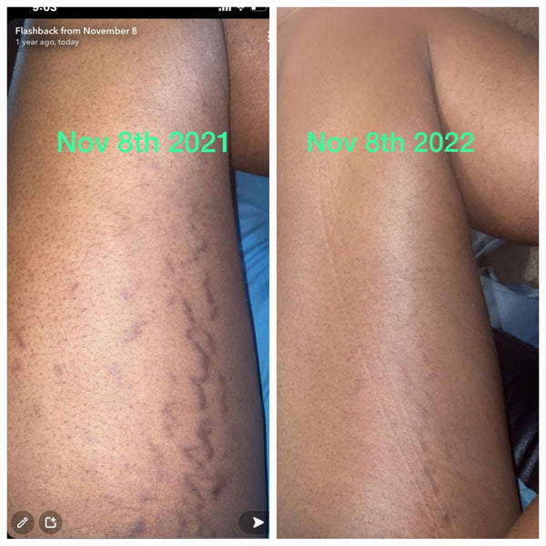 OrgAnnick Natural Ayurvedic Skincare Set (6-Pack) – Herbal Body Cream, Scrub, Soap, Toner, Serum & Cleanser with Red Palm & Kernel Oil – Paraben-Free, Sulfate-Free, Silicone-Free