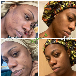 Ayurvedic Body & Facial Skincare Set