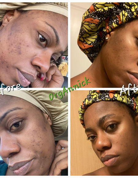 Ayurvedic Body & Facial Skincare Set