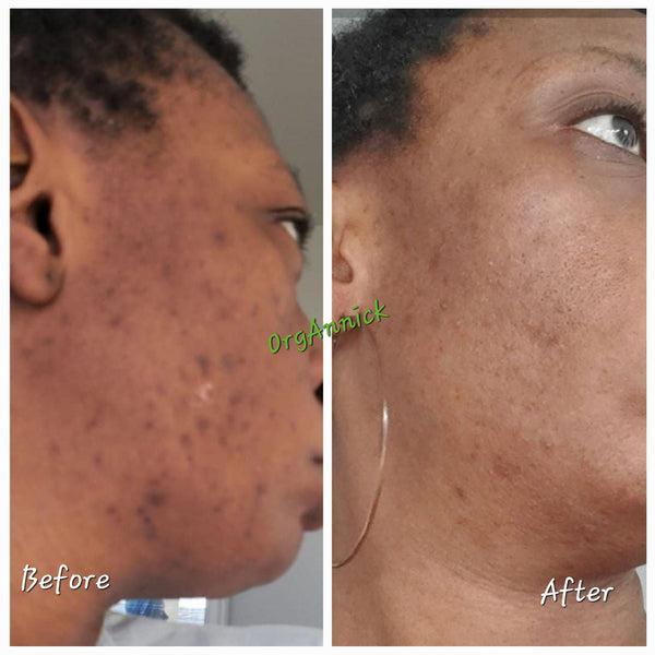 Ayurvedic Body & Facial Skincare Set