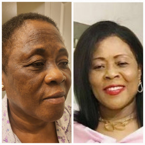 Ayurvedic Body & Facial Skincare Set