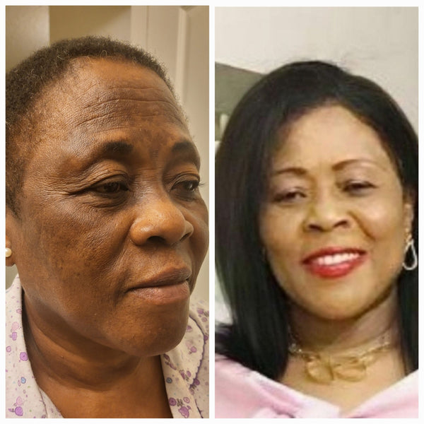 OrgAnnick Natural Ayurvedic Skincare Set (6-Pack) – Herbal Body Cream, Scrub, Soap, Toner, Serum & Cleanser with Red Palm & Kernel Oil – Paraben-Free, Sulfate-Free, Silicone-Free