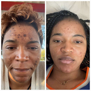 Unifying Complexion Cream (Dark Spot Remover)