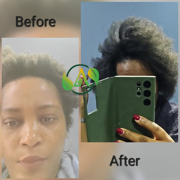 Ayurvedic Hair Set for Intense Hair Growth with Mud Mask - The Absolute Hair Favorite