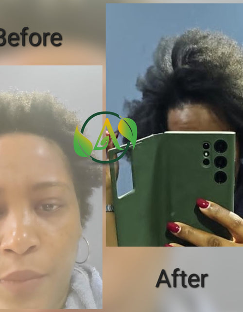 Load image into Gallery viewer, Ayurvedic Hair Set for Intense Hair Growth with Mud Mask - The Absolute Hair Favorite
