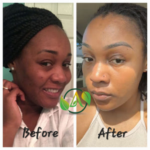 Unifying Complexion Cream (Dark Spot Remover)