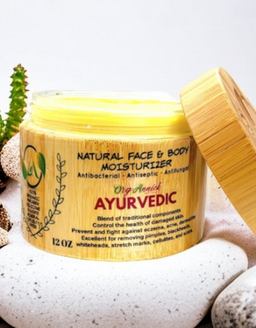 Load image into Gallery viewer, Ayurvedic Skin Perfection Moisturizer - OrgAnnick&#39;s Ayurvedic Formula for Acne Prone Skin, Uneven Tone &amp; Fine Lines. Natural Skin Renewal Moisturizer Repair &amp; Restore Skin Imperfections 12oz
