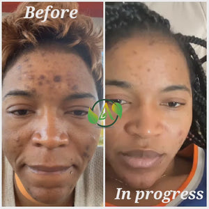 La Dame Gold Skincare Bundle – Complete Self-Care Set with Lotion, Body Wash, Serum, Soap, Face Cream & Wellness Capsules – Luxurious Everyday Essentials