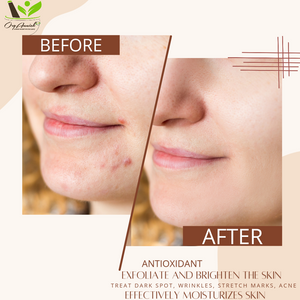 [Aloe vera Soap] - [OrgAnnick beauty]