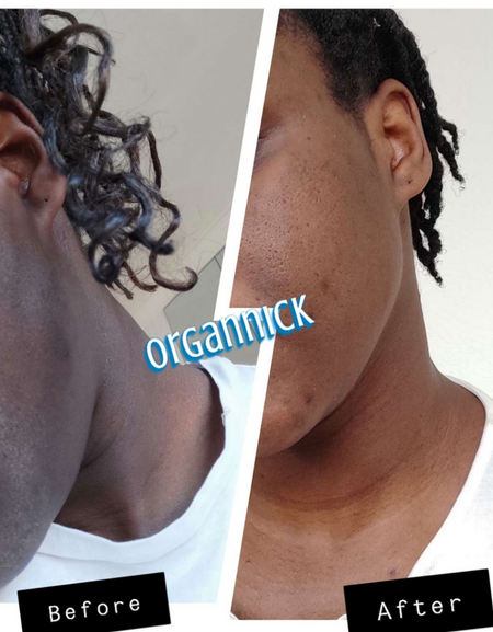 [Aloe vera Soap] - [OrgAnnick beauty]