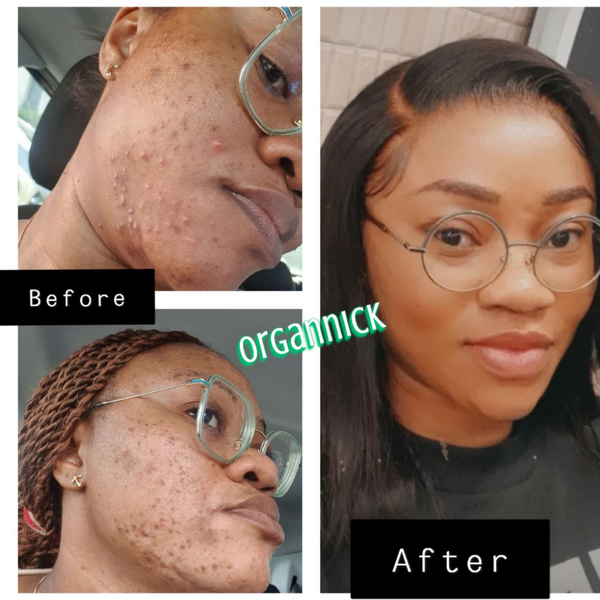 [Aloe vera Soap] - [OrgAnnick beauty]