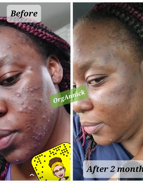 Load image into Gallery viewer, Herbal Body Oil Repair: Repair &amp; Restore Treatment Oil - 4oz
