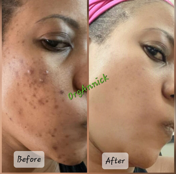 Herbal Body Oil Repair: Repair & Restore Treatment Oil - 4oz