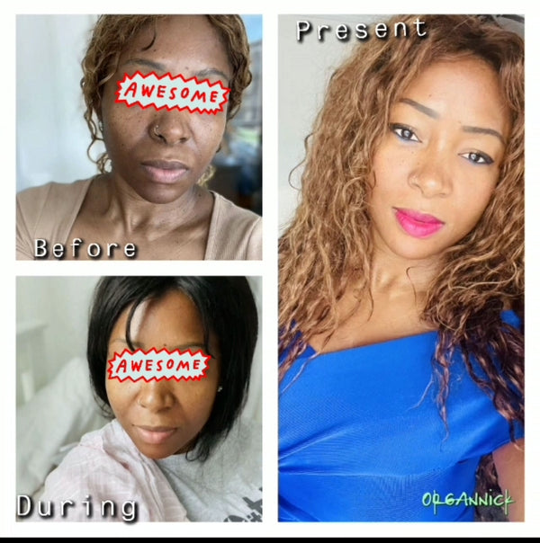 [Aloe vera Soap] - [OrgAnnick beauty]