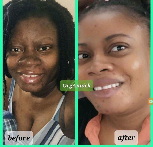 Unifying Complexion Cream (Dark Spot Remover)