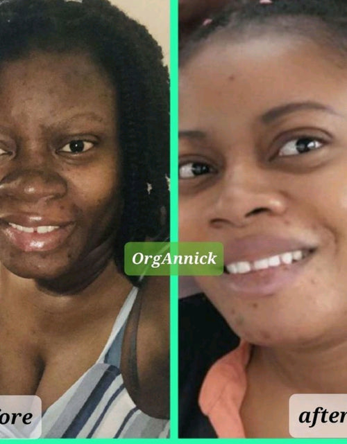 Load image into Gallery viewer, Unifying Complexion Cream (know as Dark Spot Remover)
