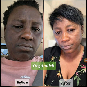 Unifying Complexion Cream (Dark Spot Remover)