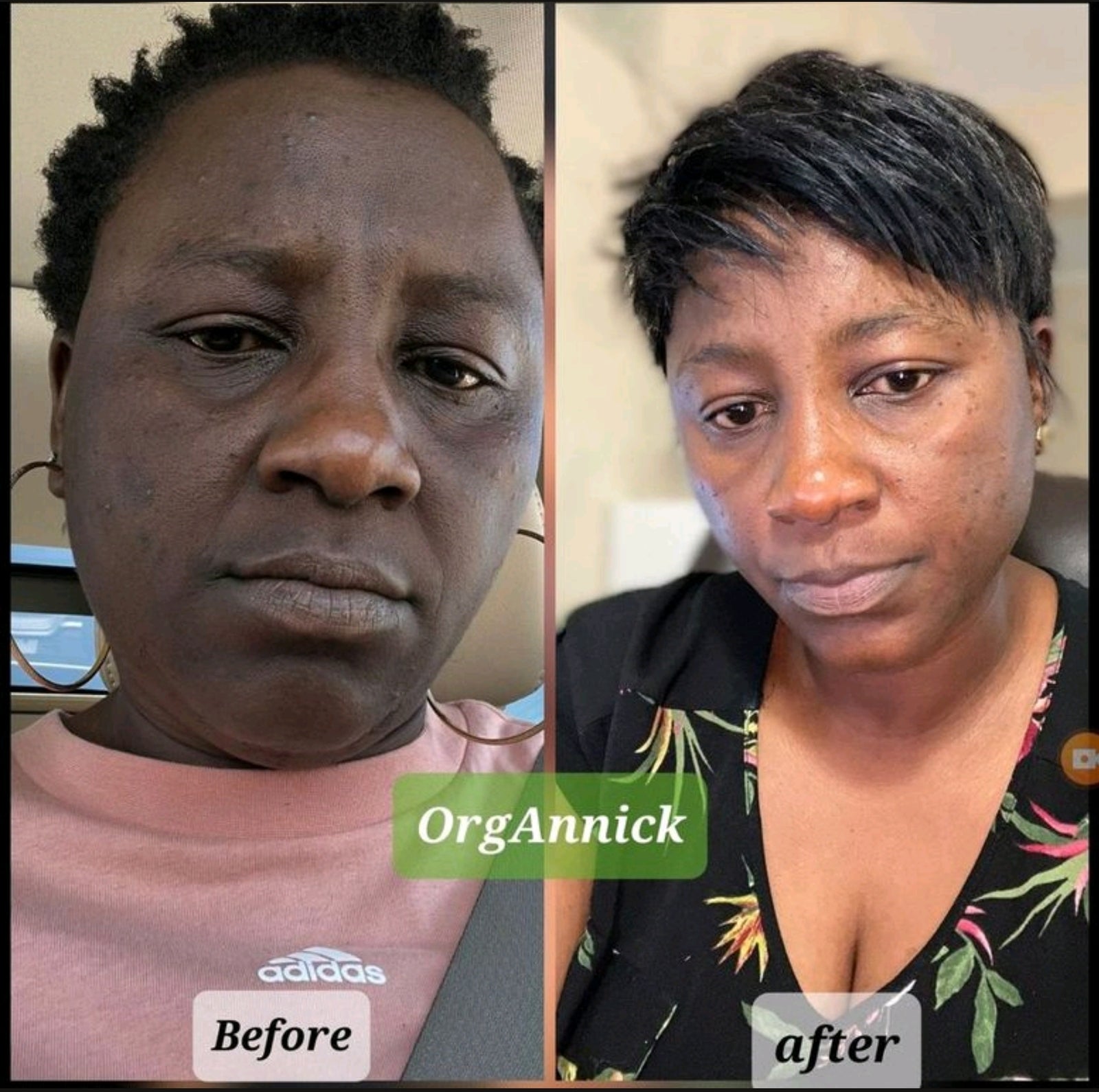 Unifying Complexion Cream (know as Dark Spot Remover)