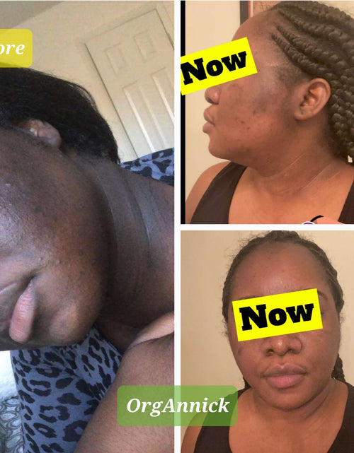 Load image into Gallery viewer, Unifying Complexion Cream (know as Dark Spot Remover)
